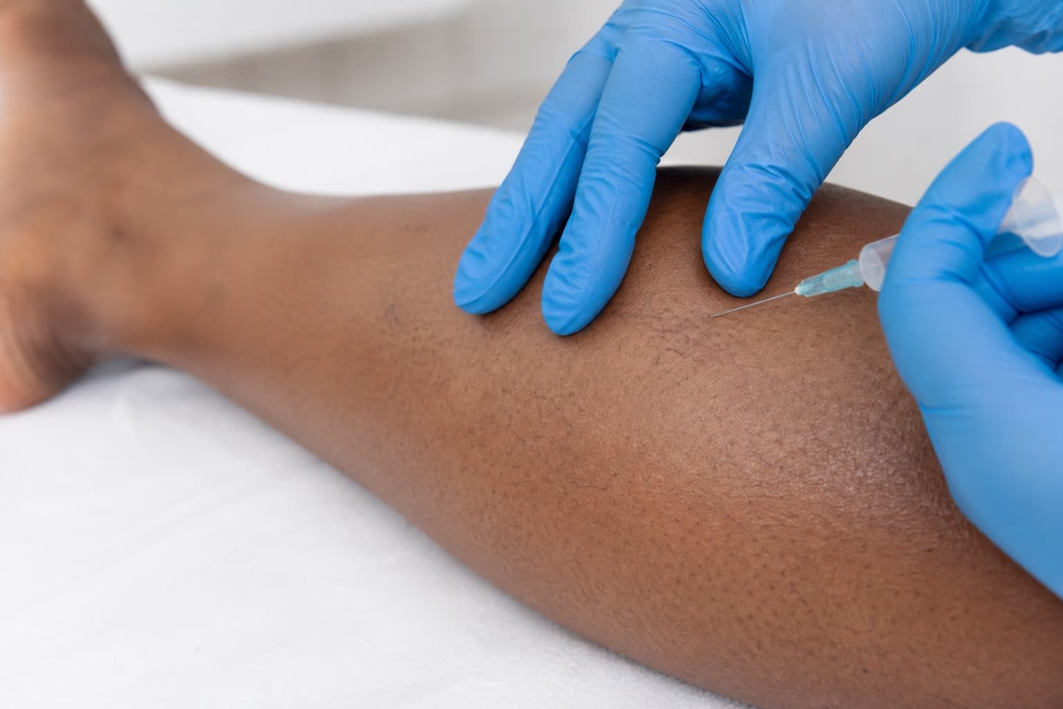 Sclerotherapy course preview